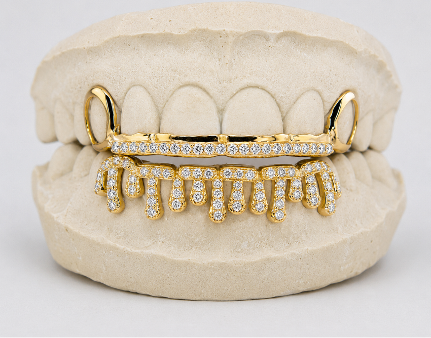 Alexis Edition; Drip & Rail Moissanite Gold Grillz – DQ1059