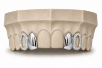 Diamond Frame Gold Grillz DQ1032