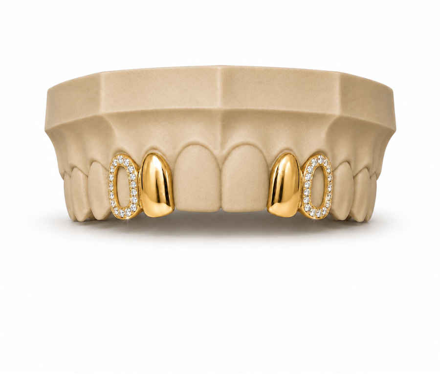 Diamond Frame Gold Grillz DQ1032