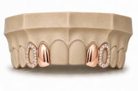 Diamond Frame Gold Grillz DQ1032
