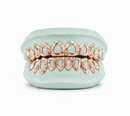 Open Face Gold Grillz -  DQ1018