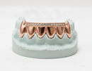 Diamond Rail Gold Grillz 6pc - DQ1020