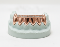 Diamond Rail Gold Grillz 6pc - DQ1020