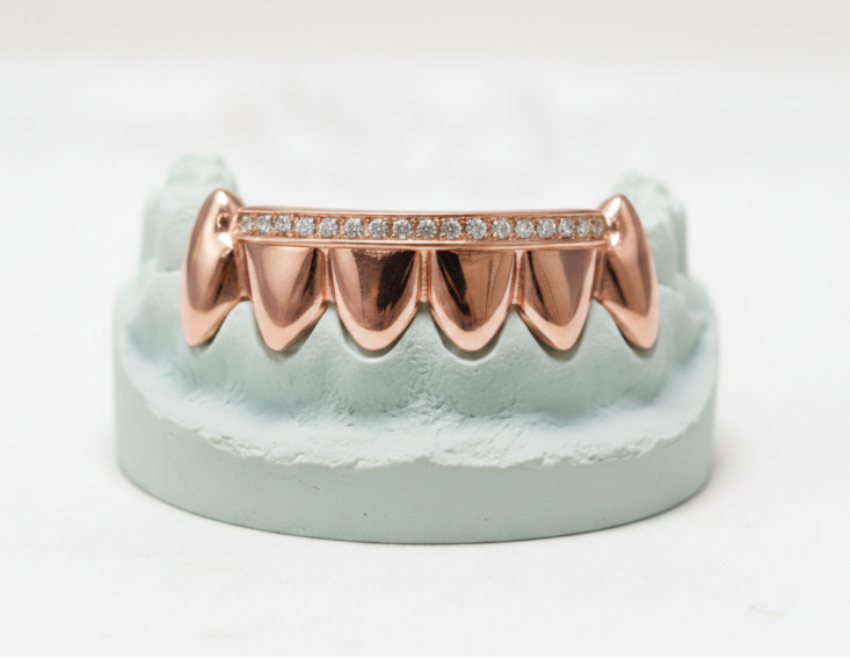 Diamond Rail Gold Grillz 6pc - DQ1020