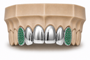 6Pack Grillz, 4 Solid Gold | 2 Iced out Fangs DQ1039