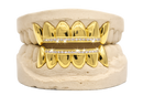 Diamond Rail Gold Grillz 6pc - DQ1020