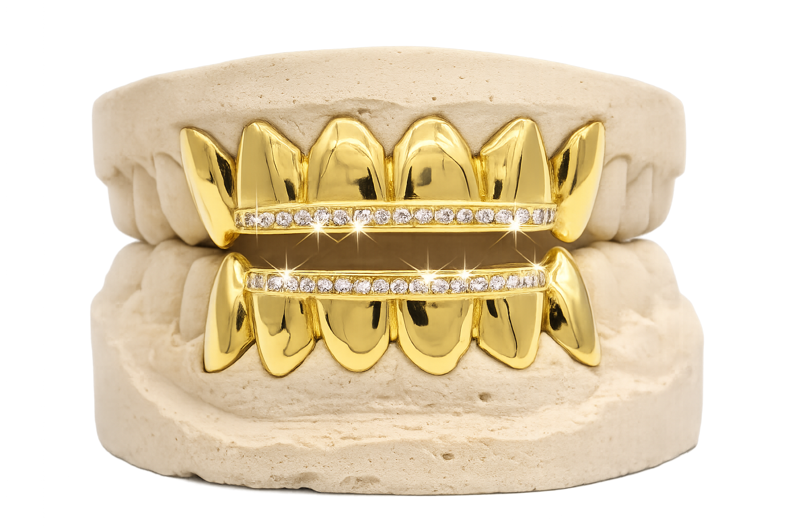 Diamond Rail Gold Grillz 6pc - DQ1020