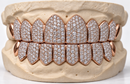Moissanite VVS Quality Iced Out  Grillz - DQ1002