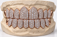 Moissanite VVS Quality Iced Out  Grillz - DQ1002