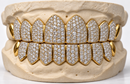Moissanite VVS Quality Iced Out  Grillz - DQ1002