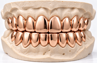 Gold Grillz - DQ1001