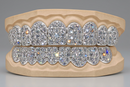 Jumbo VVS Galaxy Set  Grillz - DQ Jumbo