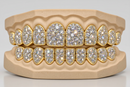 Jumbo VVS Galaxy Set  Grillz - DQ Jumbo