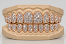 Jumbo VVS Galaxy Set  Grillz - DQ Jumbo