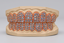 Jumbo VVS Galaxy Set  Grillz - DQ Jumbo