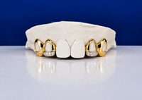 Custom Open-Face with Diamond Slugs Grillz DQ1024
