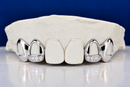Custom Open-Face with Diamond Slugs Grillz DQ1024