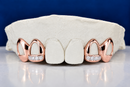 Custom Open-Face with Diamond Slugs Grillz DQ1024
