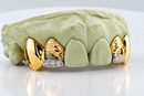 Custom Open-Face with Diamond Slugs Grillz DQ1024