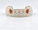 Custom Gemstone Grillz – Premium Gold with Ruby Gemstones DQ1041