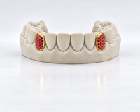 Custom Gemstone Grillz – Premium Gold with Ruby Gemstones DQ1041