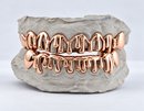 Drippy Drip Sterling Silver Grillz 8 on 8