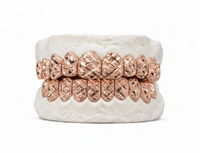 Diamond Dust - Diamond Cut Gold Grillz - DQ1012