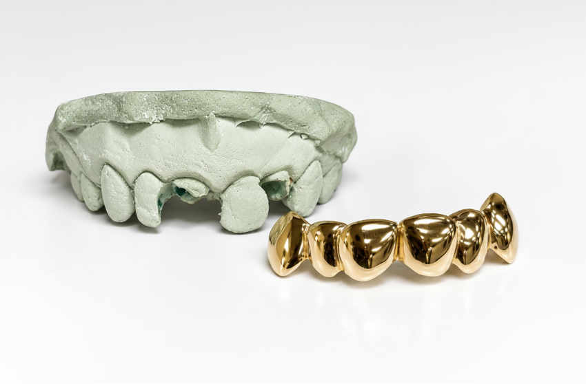 Gold Grillz With Missing Teeth - DQ1001 MT