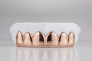 Top Bar Diamond Set Grillz - DQ1042