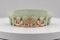 Victorian Scroll Grillz DQ1054