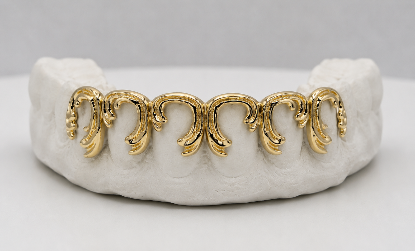 Victorian Scroll Custom Gold Grillz | Luxury Grillz by Gold Teeth