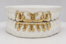 Victorian Scroll Grillz DQ1054