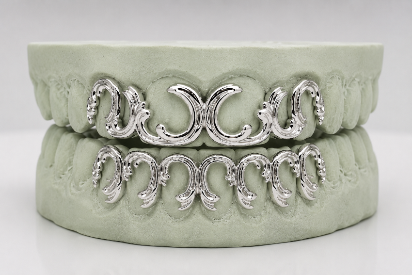 Victorian Scroll Custom Gold Grillz | Luxury Grillz by Gold Teeth