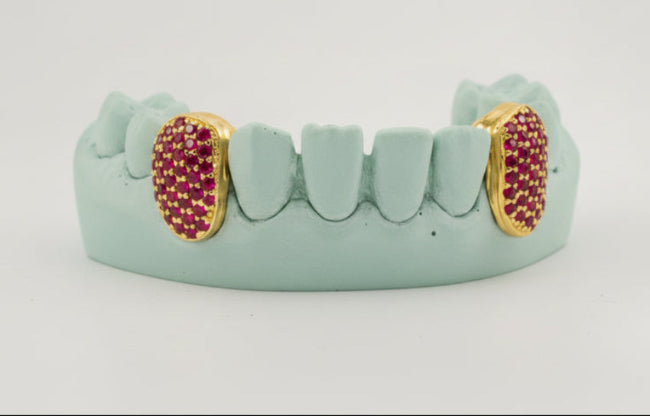 Custom Gemstone Grillz – Premium Gold with Ruby Gemstones DQ1041
