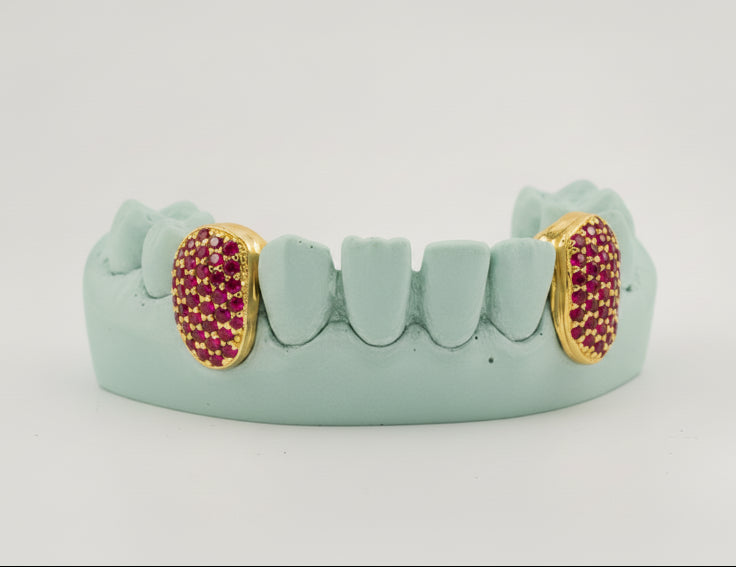 Custom Gemstone Grillz – Premium Gold with Ruby Gemstones DQ1041