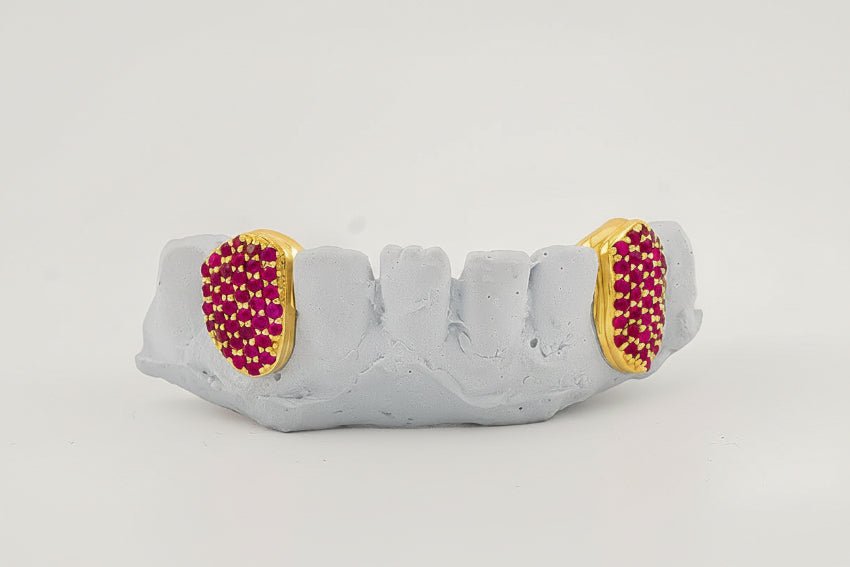 Custom Gemstone Grillz – Premium Gold with Ruby Gemstones DQ1041