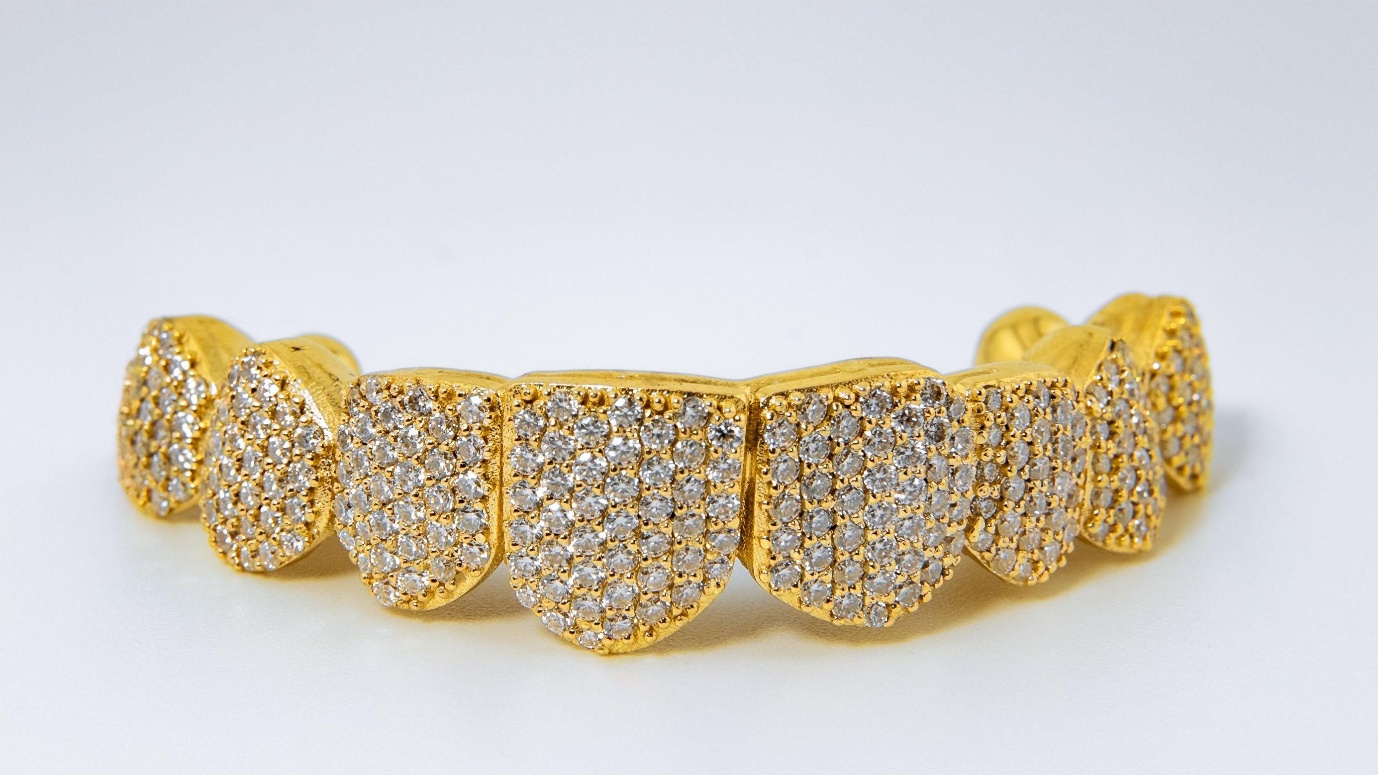 VVS Natural Diamond Grillz: Luxury for Your Smile