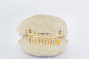 Silver Moissanite Drip Grillz 6pc DQ1053