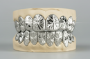 Starbust Cut Grillz - DQ1044