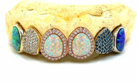 Custom Gemstone Grillz – Premium Gold with Ruby Gemstones DQ1041