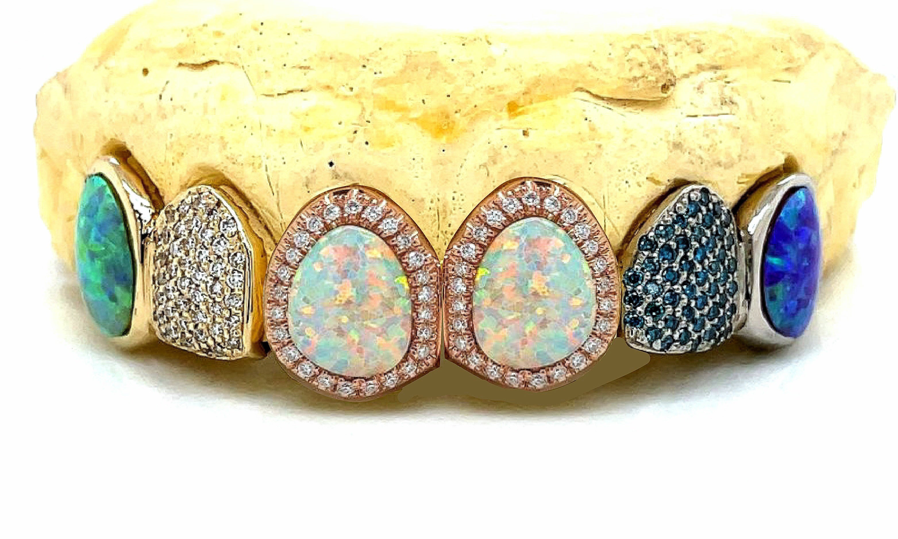 Custom Gemstone Grillz – Premium Gold with Ruby Gemstones DQ1041