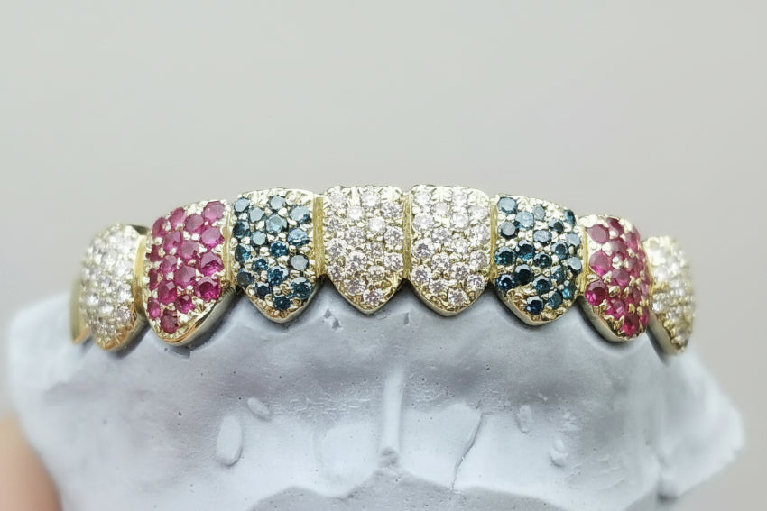 Custom Gemstone Grillz – Premium Gold with Ruby Gemstones DQ1041