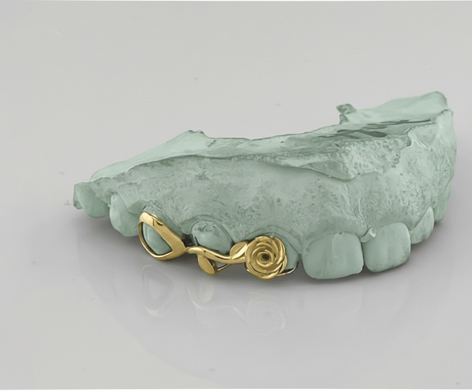 Rose Stem Grillz - Gold Teeth America