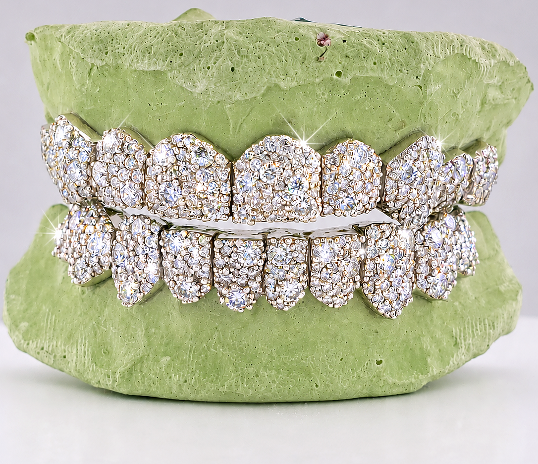 Jumbo VVS Galaxy Set  Grillz - DQ Jumbo