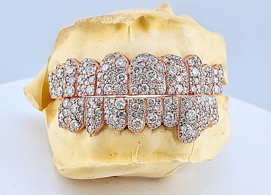 Jumbo VVS Galaxy Set  Grillz - DQ Jumbo