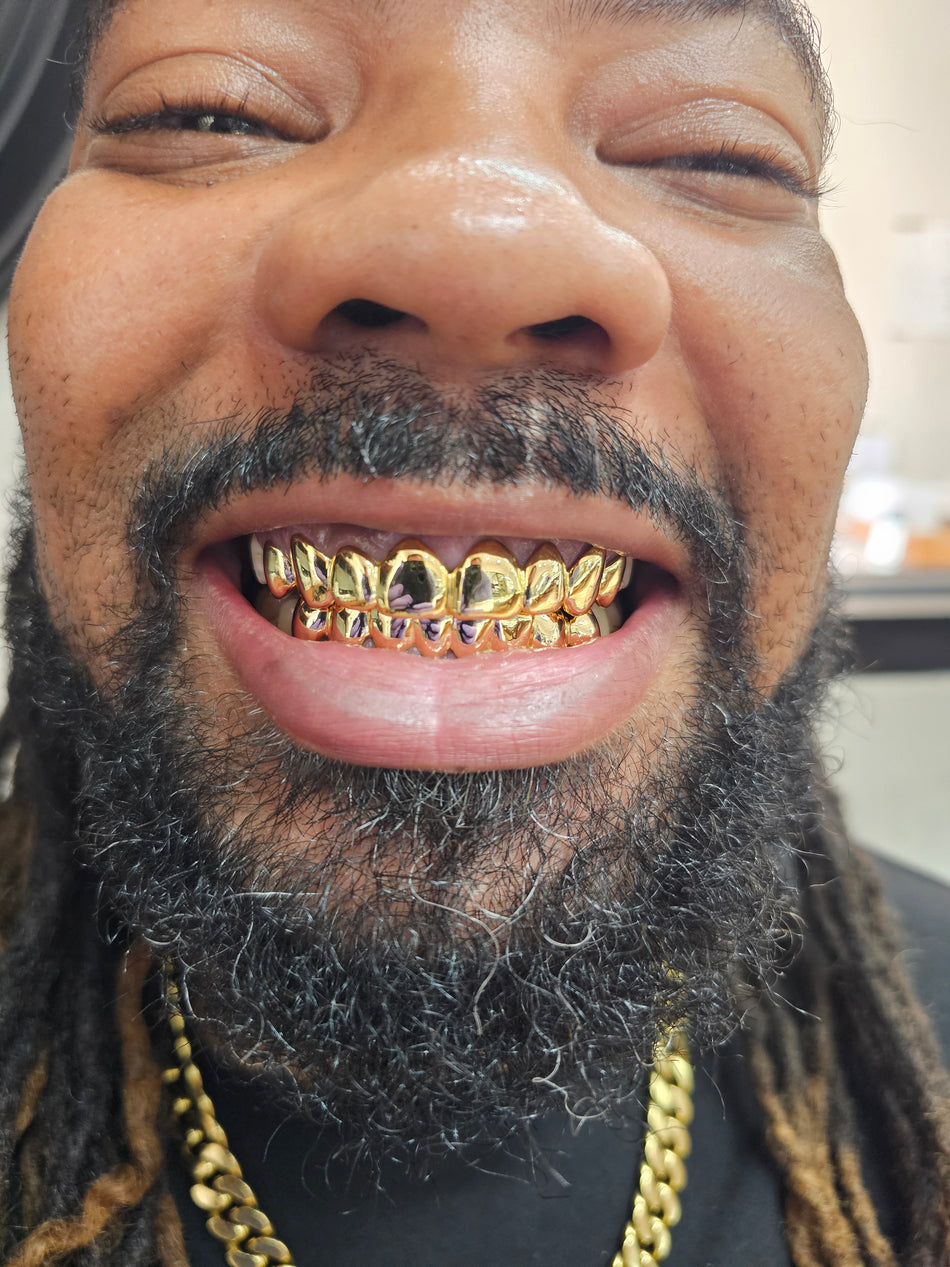 Dental Gold Grillz - NPG or 8K Gold Grillz – Gold Teeth America