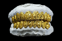 Dental Gold Grillz - NPG or 8K Gold Grillz
