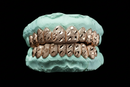 Diamond Dust - Nugget Cut Grillz - DQ1012Ngt