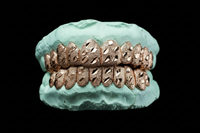 Diamond Dust - Nugget Cut Grillz - DQ1012Ngt