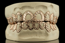 Open Face Gold Grillz -  DQ1018